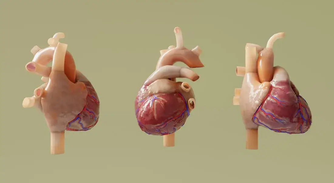 Interventional cardiology